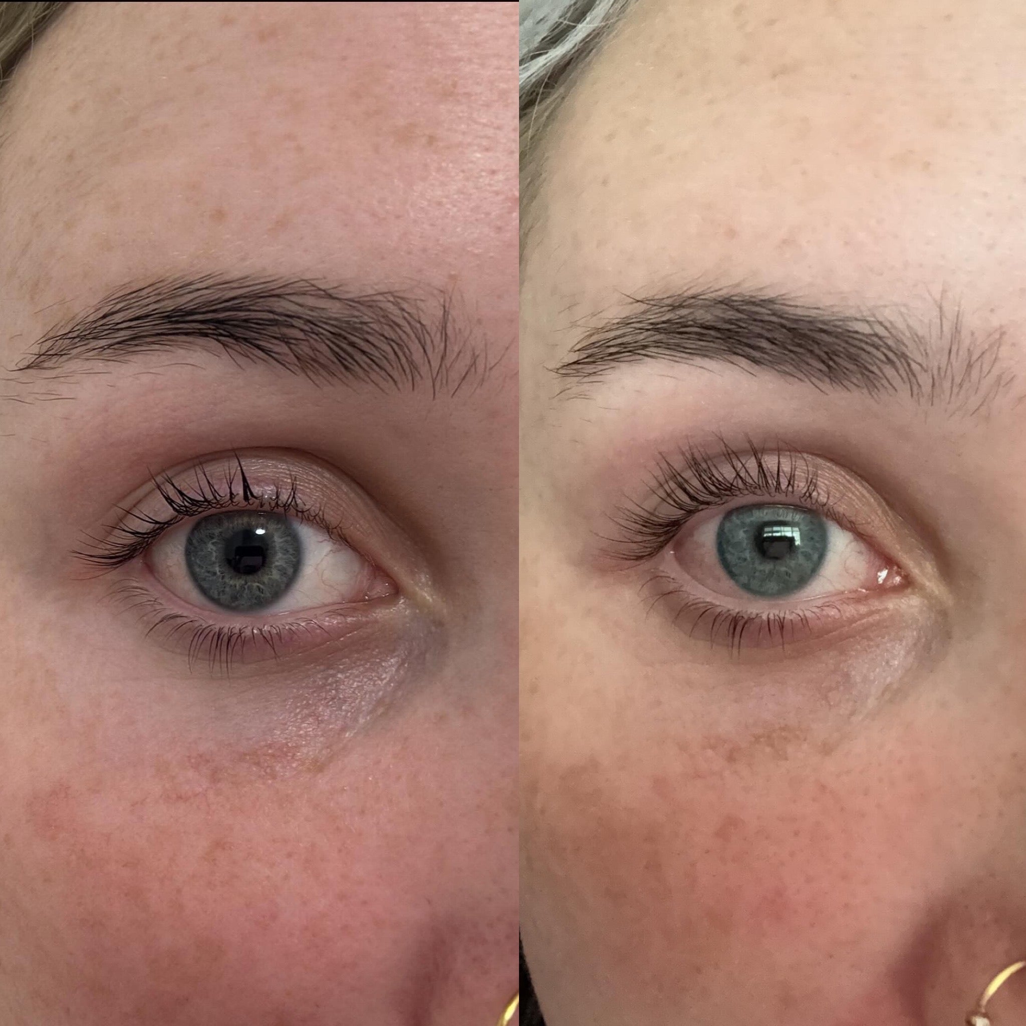 Eyelash Growth Serum