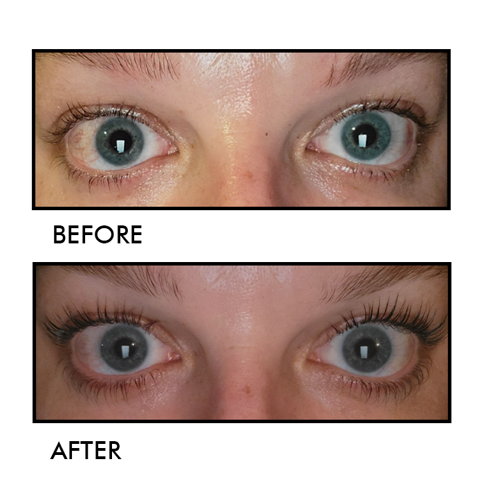 Eyelash Growth Serum