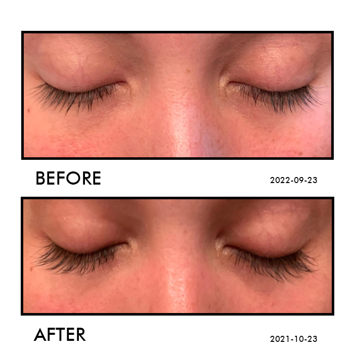 Eyelash Growth Serum