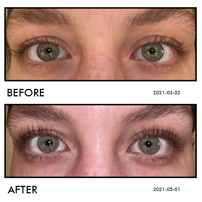 Eyelash Growth Serum